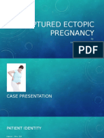 Ruptured Ectopic Pregnancy: Case Presentation and Management