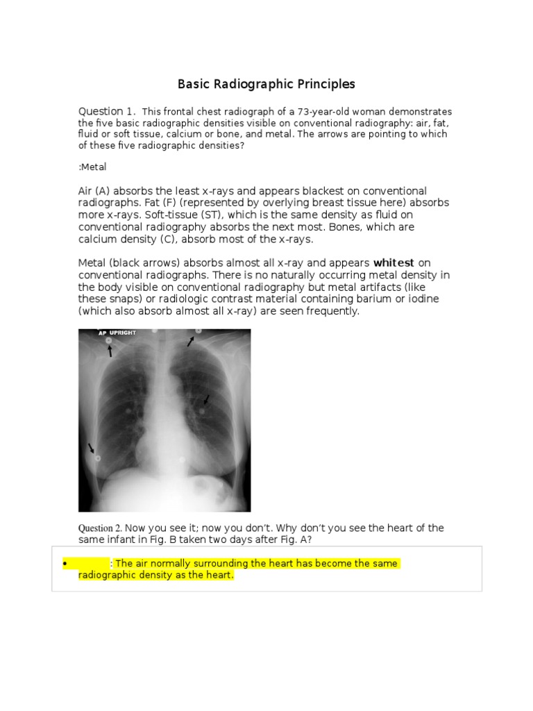 Basic Radiographic Principles PDF Lung Lung Cancer