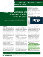Malassezia Species:: Seborrheic Dermatitis and
