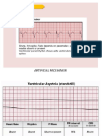 Ecg Strips