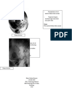 Crs 2 Radiologi Mastoid (Marry)