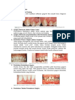 Gambaran Klinis Gingivitis