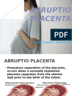 Abruptio Placenta: By: Princess Grace A. Pechon, SN