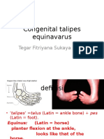Congenital Talipes Equinavarus