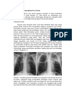 Pencitraan Pada Aspergilosis Paru Kronik