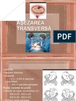 Asezarea Transversa Sarcina Gemelara