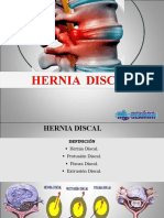 Hernia Discal