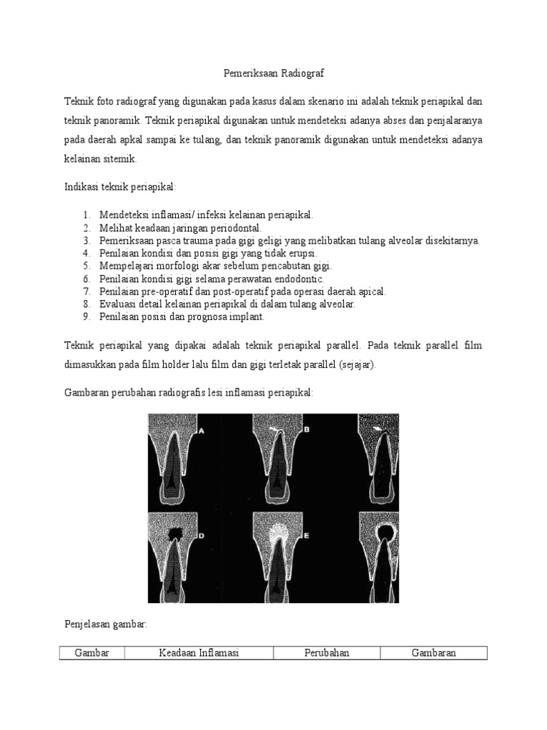 Interpretasi Radiografi Periapikal dan Panoramik | PDF