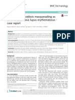 Cutaneous Sarcoidosis Masquerading As