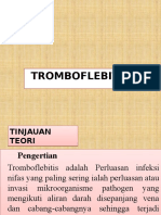 Tromboflebitis