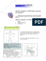 ECG Lecture Rapide