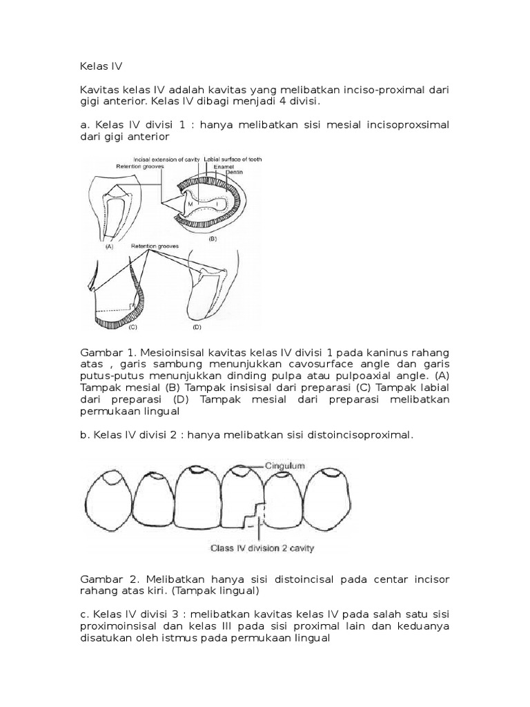 Kelas IV