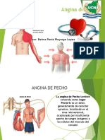 Angina de pecho: causas, tipos y tratamiento