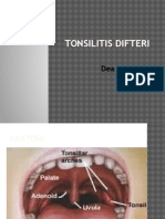 Tonsilitis Difteri