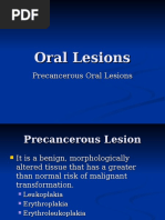 Premalignant Oral Lesions