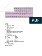 Contoh Interpretasi Ekg