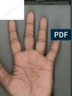 Left  HAND.pdf