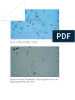 Sedimen Urine