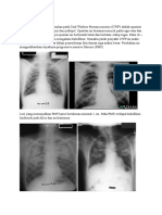 Radiologi Coal Worker Pneumoconiosis