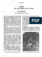 Rhinolith A Brief Review of The Literature And: Marfatia