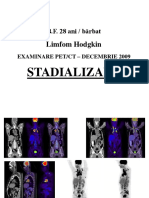 Lh Stadializare Si Evaluarea Raspunsului La Tratament