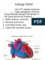 Tetralogy Fallot