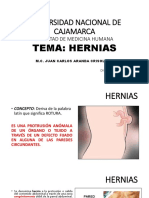 Hernias