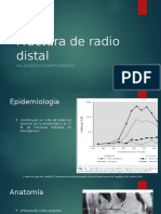 Fractura de Radio Distal