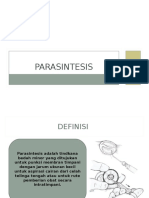 Parasintesis