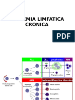 Leucemia Limfatica Cronica