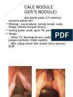 Vocal Nodule