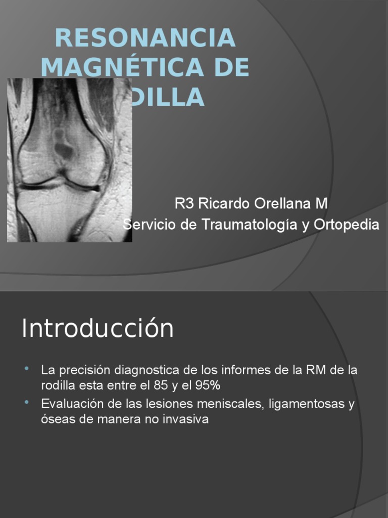 Resonancia magnetica de rodilla | Rodilla | Articulaciones