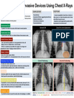 Invasive Devices On CXR