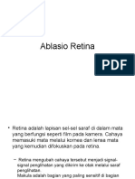 Ablasio Retina