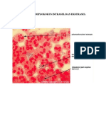 Gambaran Diplokokus Intrasel Dan Ekstrasel