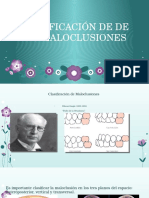 Maloclusion Ortodoncia