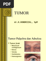 Tumor Mediastinum
