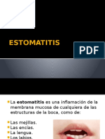 ESTOMATITIS.pptx