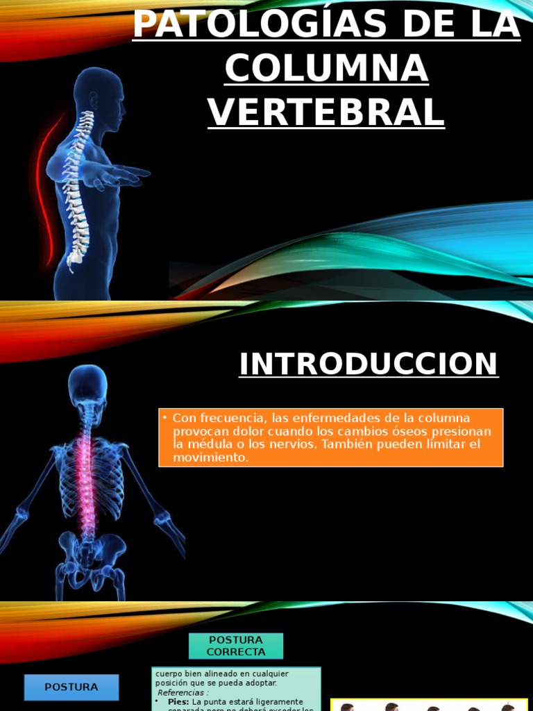 Patologías Comunes de la Columna Vertebral | PDF | Sistema esquelético ...