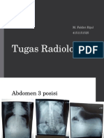 Radiologi Abdomen, Pelvis, Kepala dan Dada