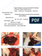 11. Trombosis Vena Mesentrika