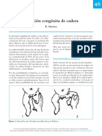 luxacion congenita de cadera.pdf