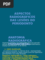 Aspecto Radiográfico Das Lesões Do Periodonto