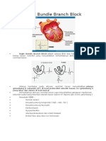 Right Bundle Branch Block