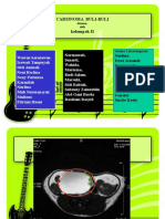 Carsinoma Buli-buli (Kmb)