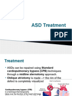 Treatment ASD