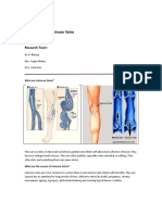 Varicose Veins