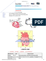 MI EKG Finding