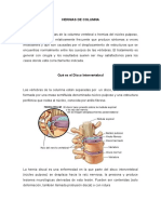 Hernias de Columna