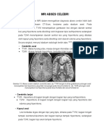 Mri Abses Celebri